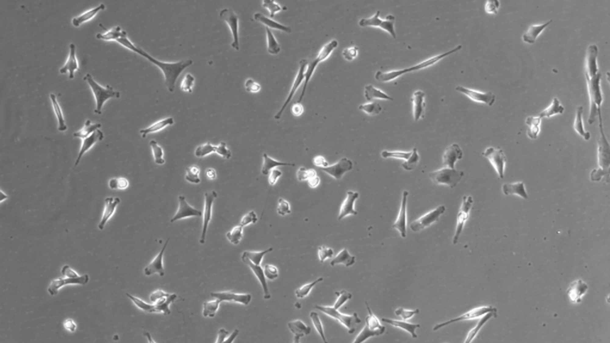 Microscopía de células troncales mesenquimales